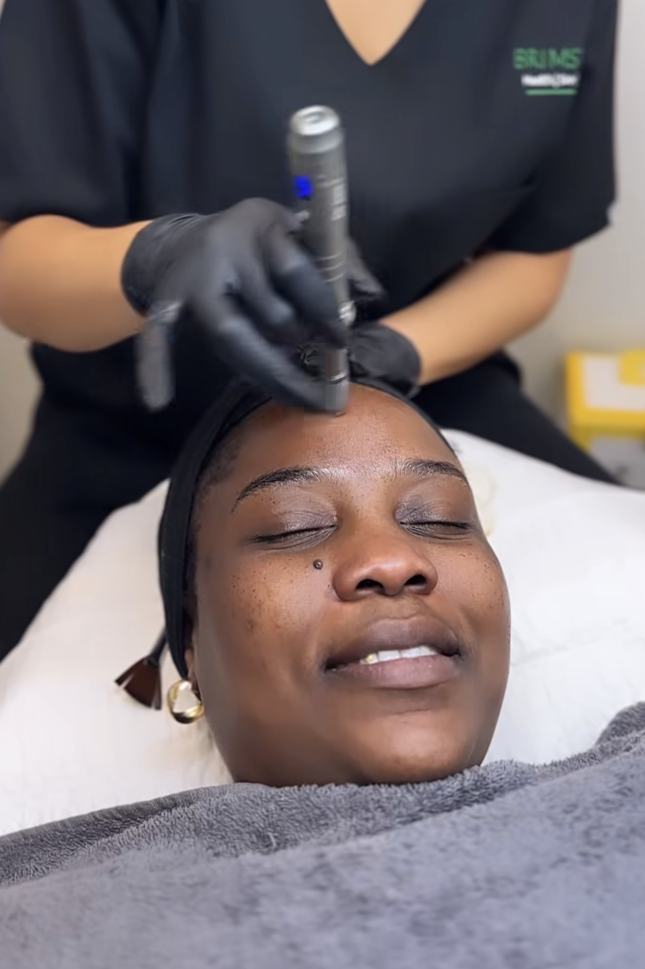 A Brimstone Medical clinician performing a microneedling facial on a patient