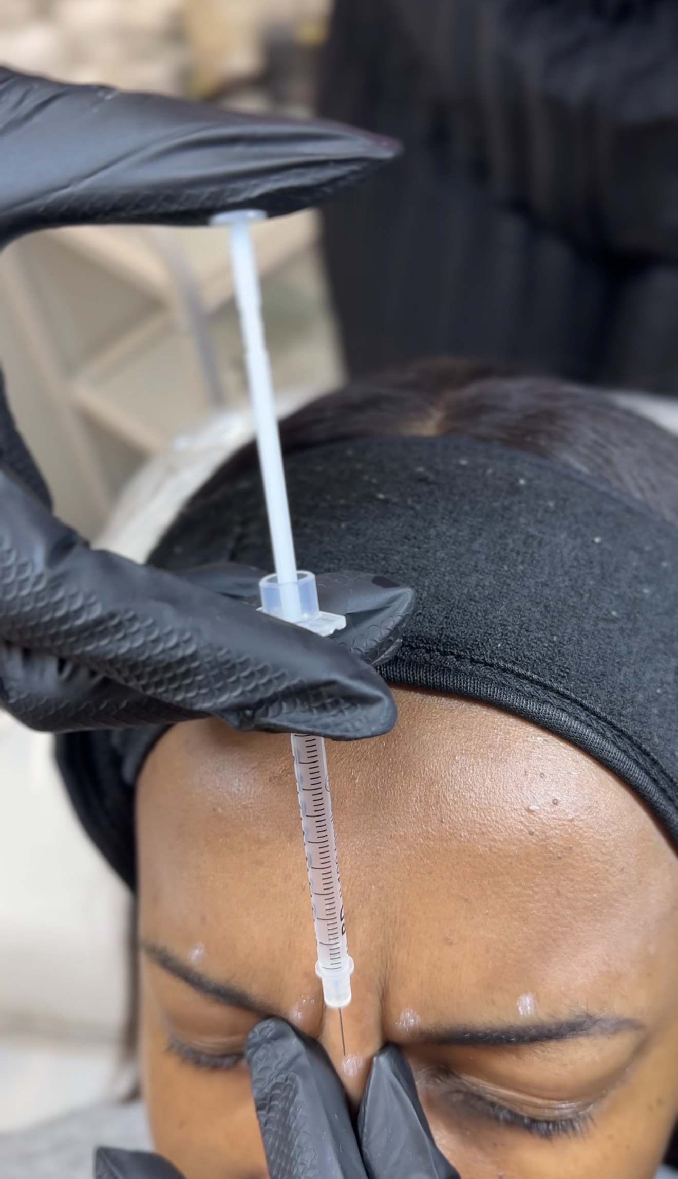 A skin booster being injected into a patient's forehead at Brimstone Medical