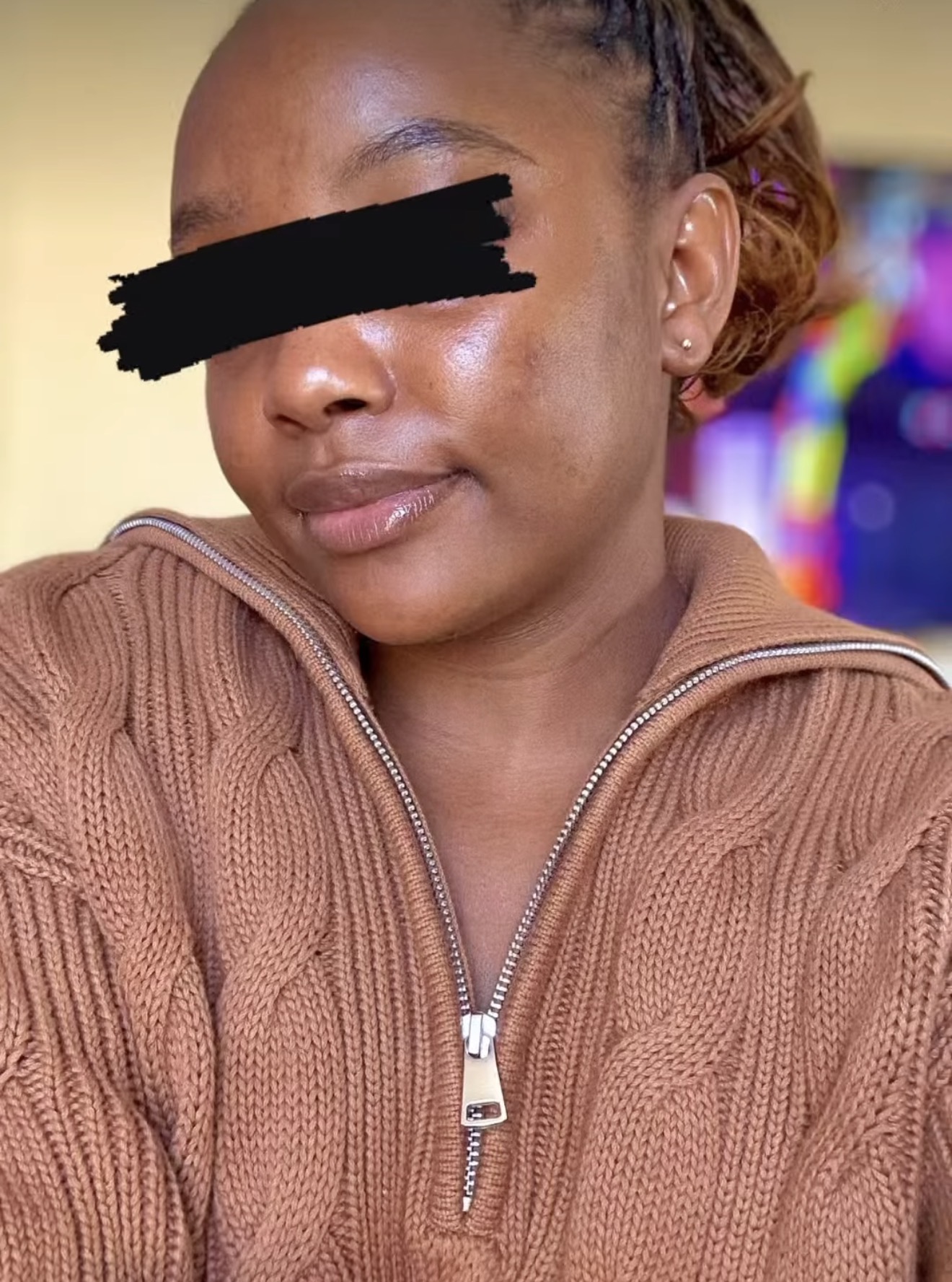 Before and after: Glass Skin Programme